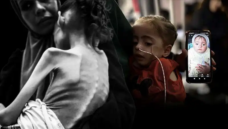 Küçük Meryem’in Zorlu Açlık Mücadelesi: 25 Kilodan 10 Kiloya Düşen Hayat Hikayesi