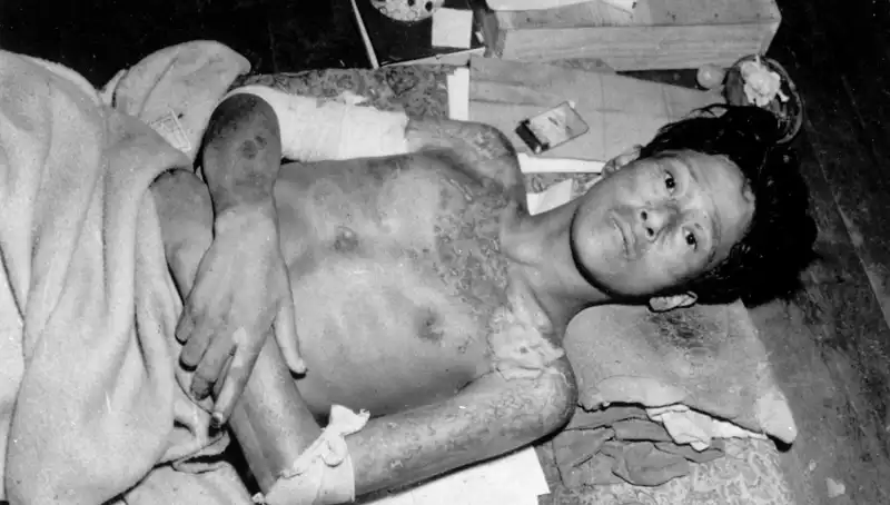 80 Yıl Sonra Nagasaki'den Gelen Çarpıcı Uyarı: Nükleer Felaket Kapıda mı?